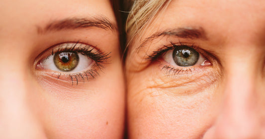 Our beauty enthusiasts ask, and we answer: Can my teenage daughter with acne use your cream?